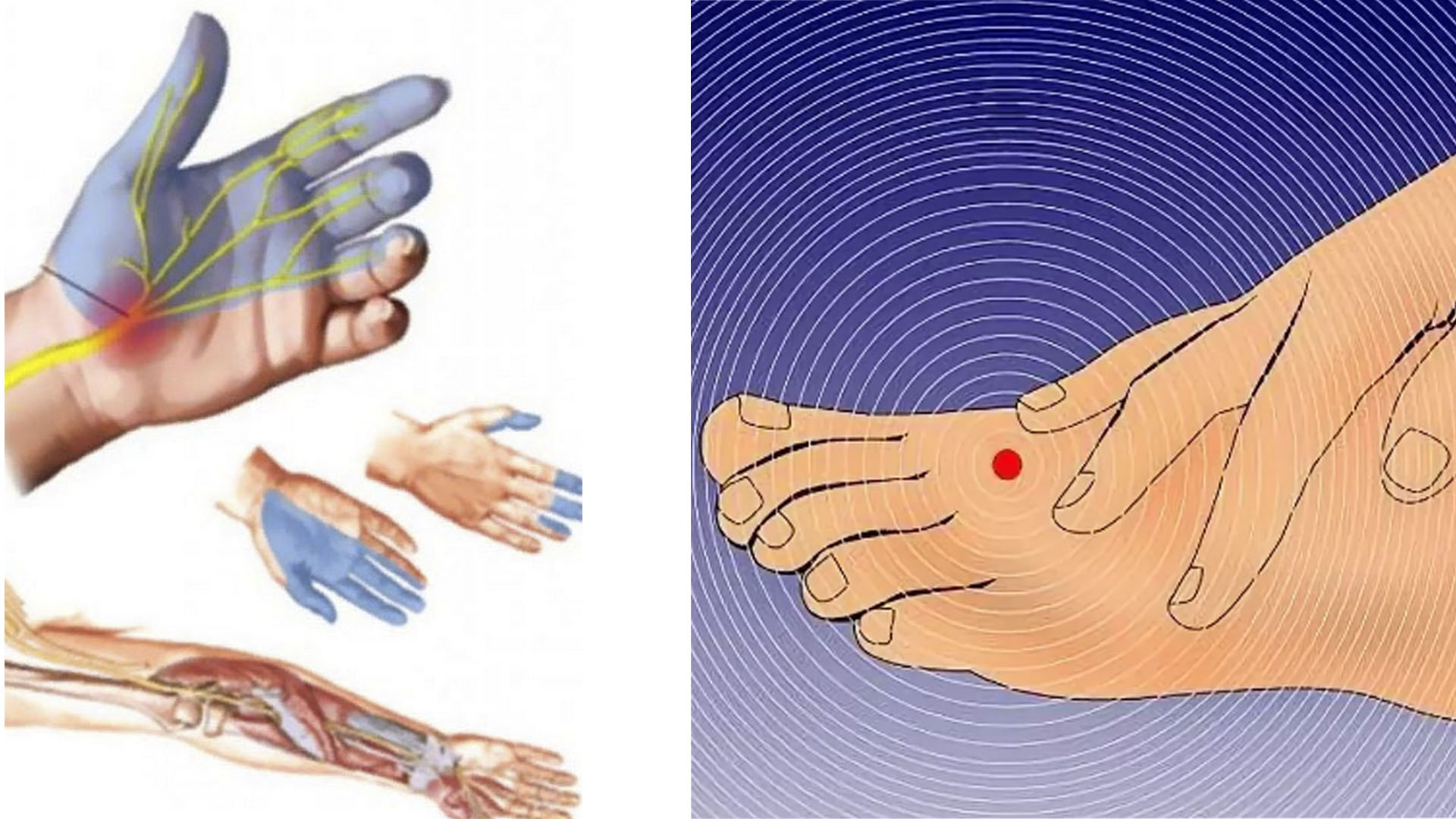 Онемение пальцев после операции