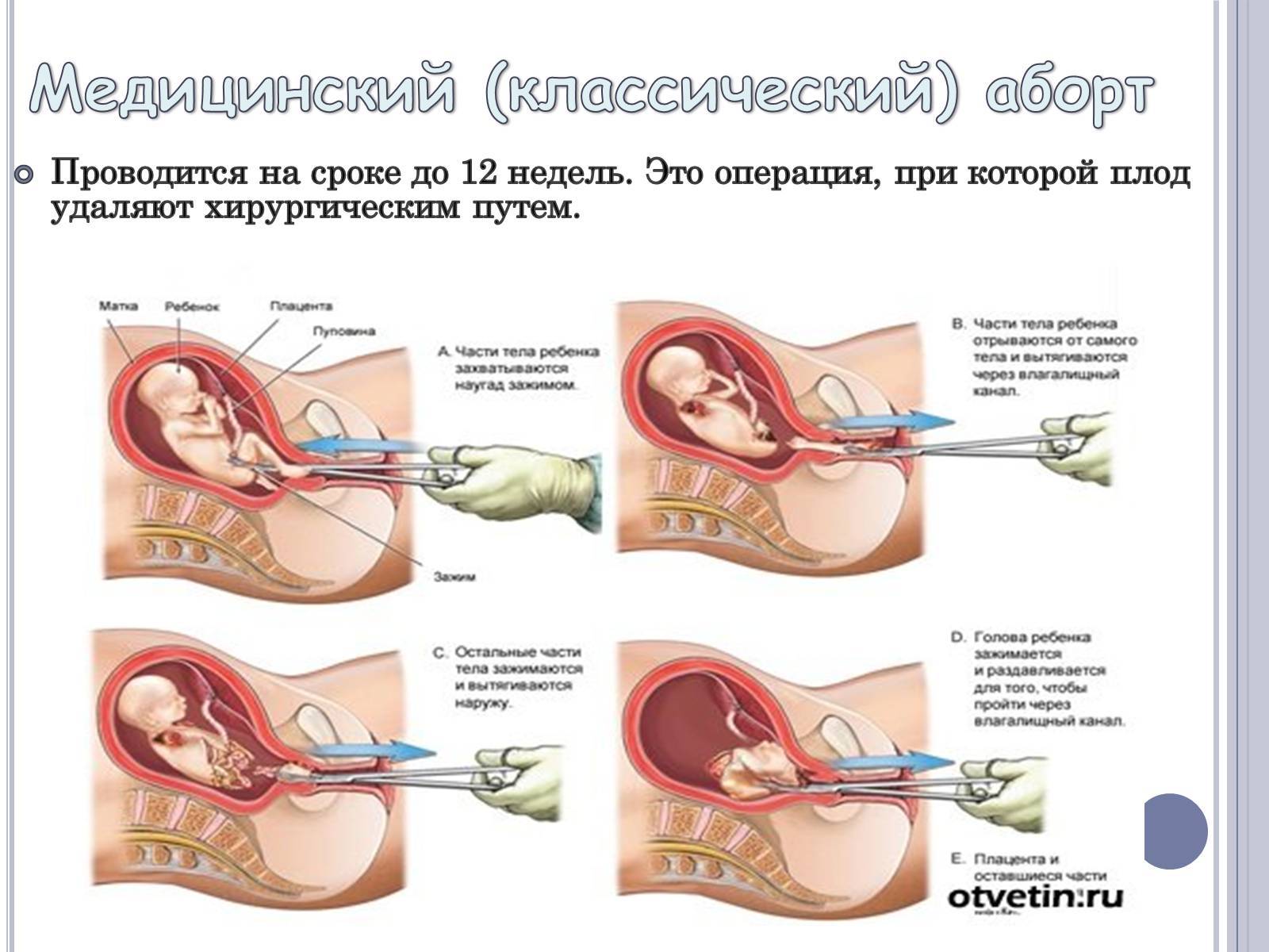 чем может опасен оргазм при беременности фото 32