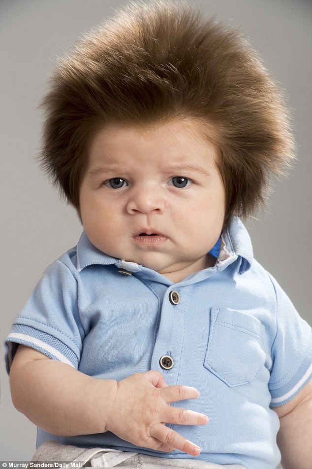 Even though pictures of two-month-old Junior Cox-Noon’s bouffant hair went viral last week, making the Brighton baby look particularly blessed, he will have around the same number of follicles as any other child