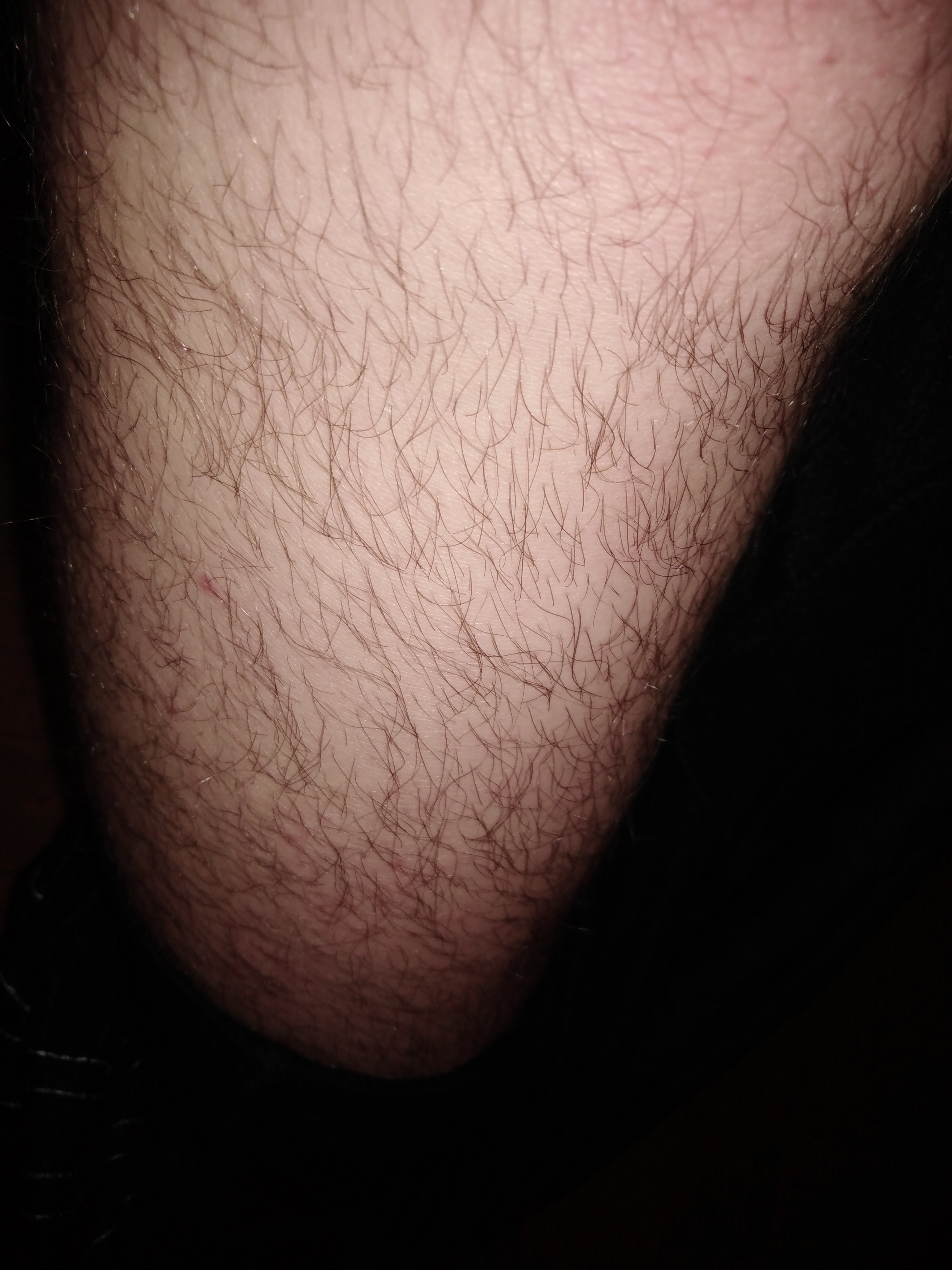 сонник волосатые ноги своими фото 28