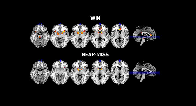 Brain scans of players who almost win a game of chance show similar brain activity in reward pathways to those who actually win.